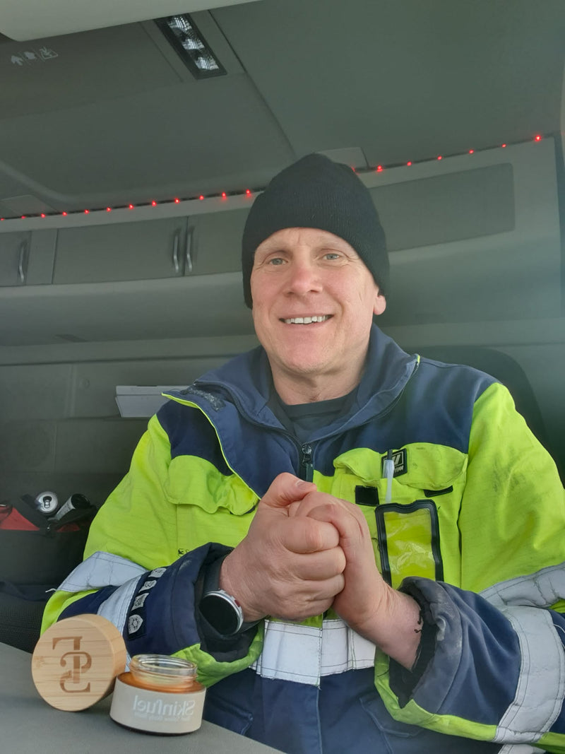 Hudvårdsresultat före och efter